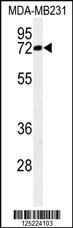 MCMBP Antibody