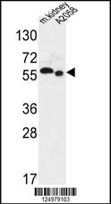 SLC47A2 Antibody