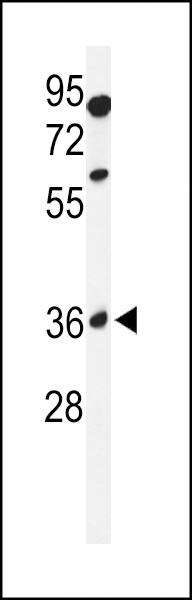 GL8D2 Antibody
