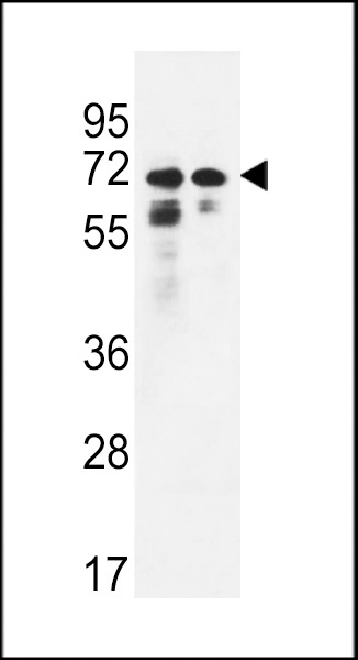 PNPLA8 Antibody