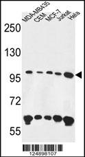 ANKFY1 Antibody