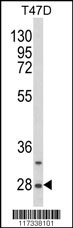 SNRPB Antibody