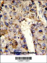 HNRNPL Antibody