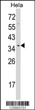 STRAP Antibody