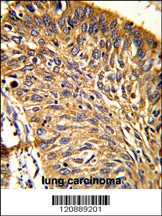 PRDX3 Antibody