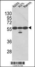 PDIA3 Antibody