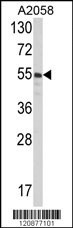 PDIA3 Antibody