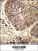 PDIA3 Antibody