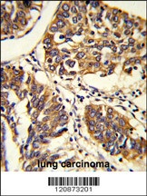 PABPC1 Antibody