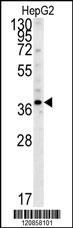 PSMD7 Antibody