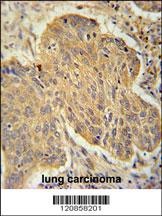 PSMD7 Antibody