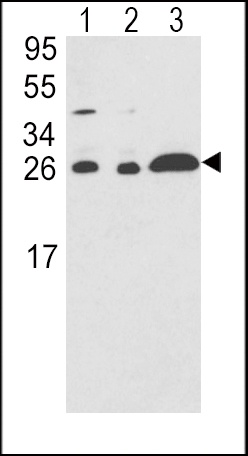 ARHGDIA Antibody