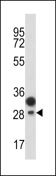 PROCR Antibody