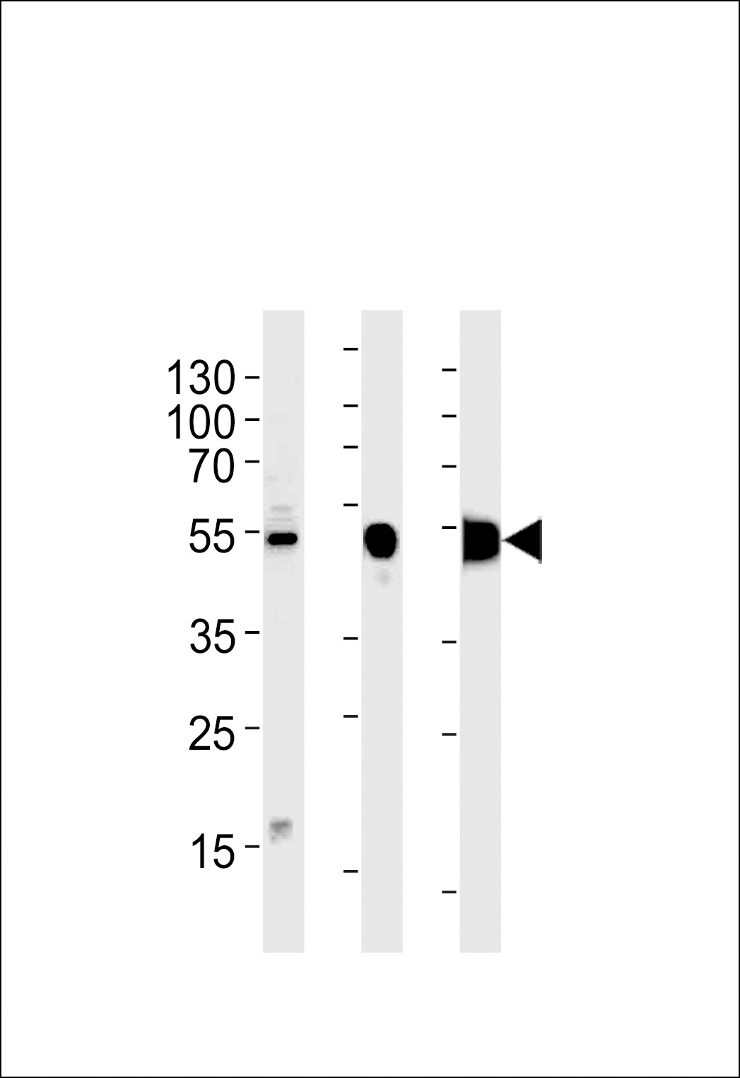 ENO3 Antibody