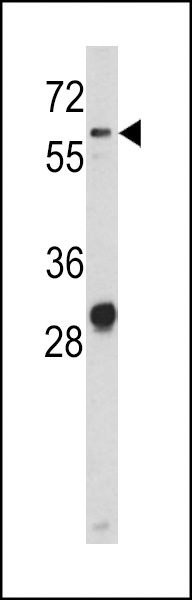 ALCAM Antibody
