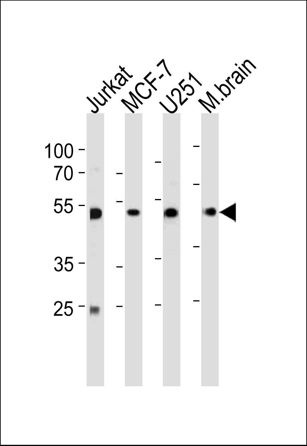 ENOA Antibody
