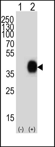 CD38 Antibody