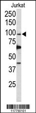 POLD1 Antibody