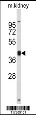 RFC3 Antibody