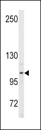 ENPP2 Antibody