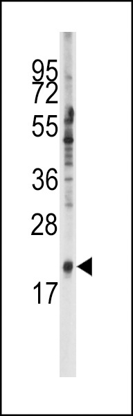 SNRPC Antibody