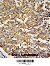 KRT19 Antibody