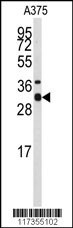 STX3 Antibody