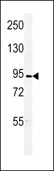 DLGAP5 Antibody