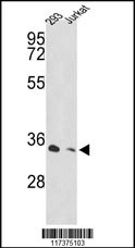 PSMD11 Antibody