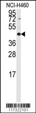 RMND5B Antibody