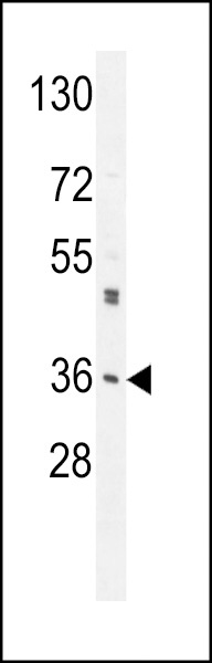 M6PR Antibody