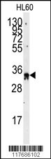 EXOSC8 Antibody