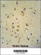 ZIC3 Antibody