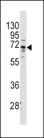 FZD1 Antibody