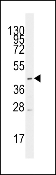 MCT1 Antibody