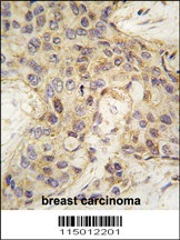 ANGEL2 Antibody
