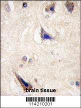 LGR5 Antibody