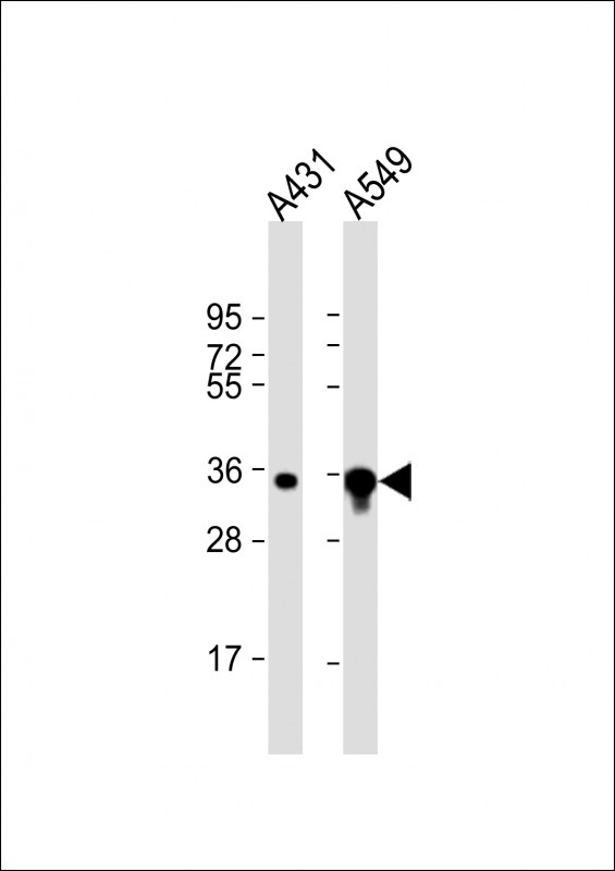 AKR1B1 Antibody