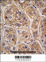 AKR1A1 Antibody