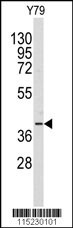 AKR1A1 Antibody