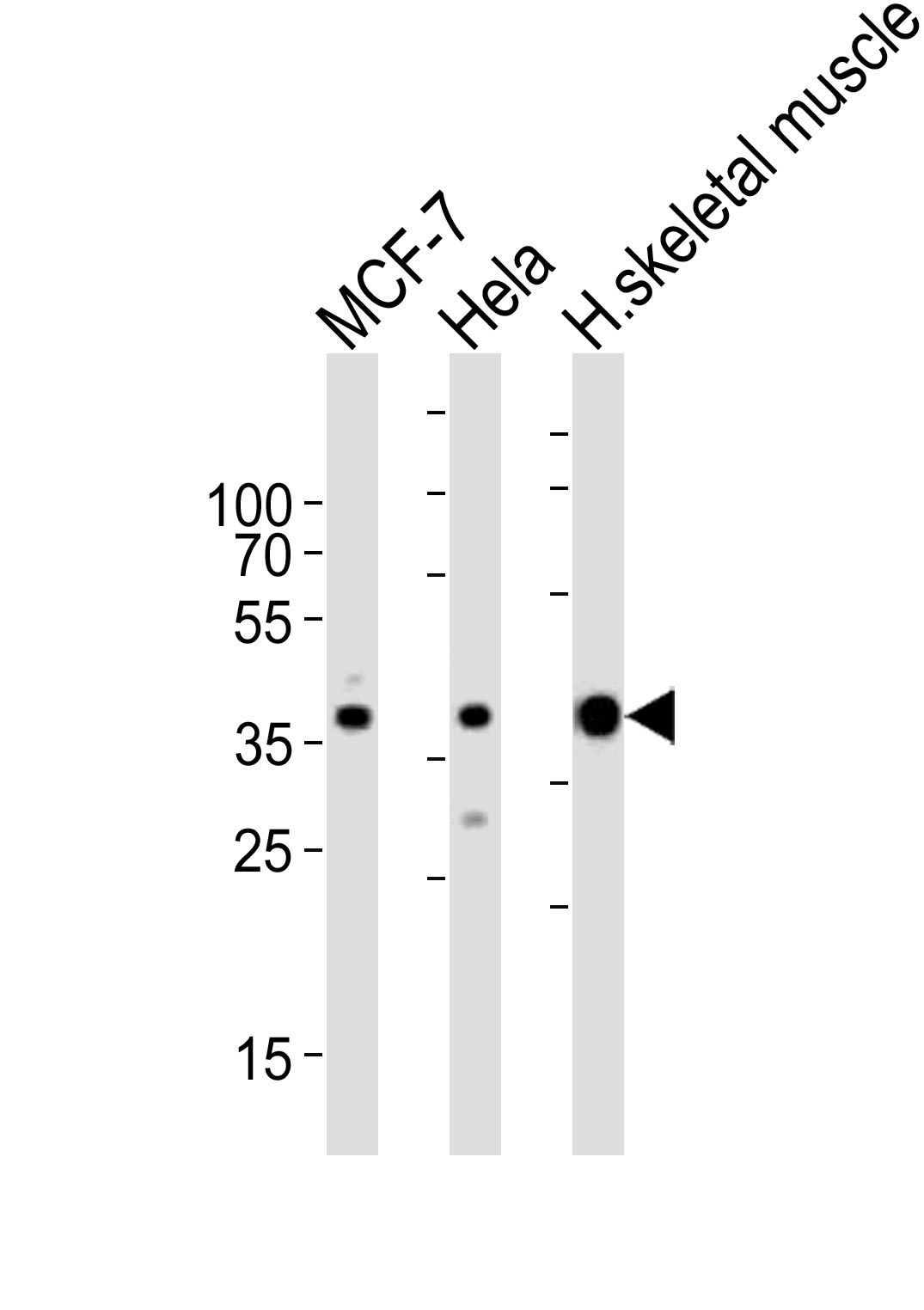 ALDOA Antibody