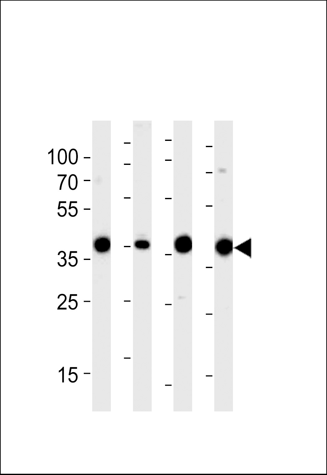 Aldolase Antibody