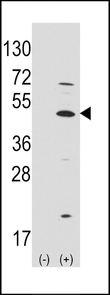 MATH1/HATH1/ATOH1 Antibody