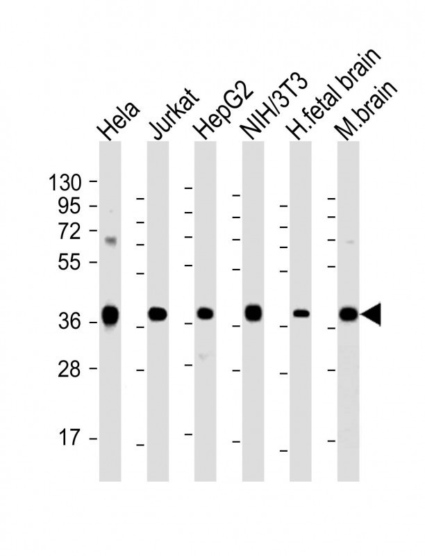 MATH1/HATH1/ATOH1 Antibody