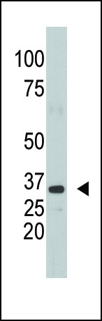SULT1A1 Antibody