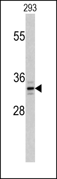 PPT1 Antibody