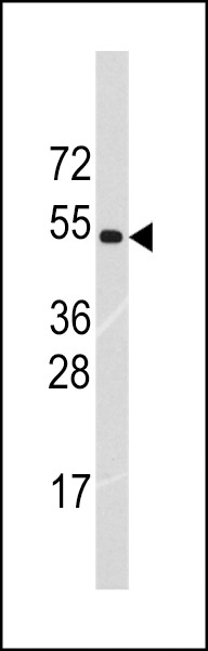 TRIM69 Antibody
