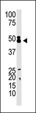 CBX8 Antibody