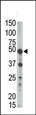 PIGK Antibody