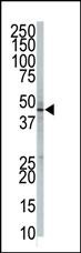 PIGK Antibody